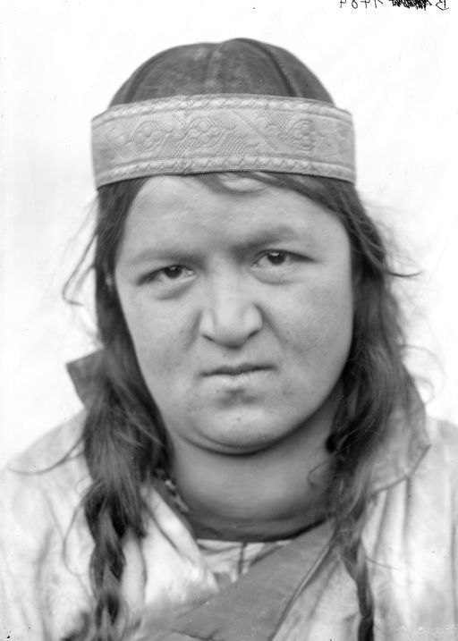 B 1484: Frau mit Kropf, (Kurtisane)