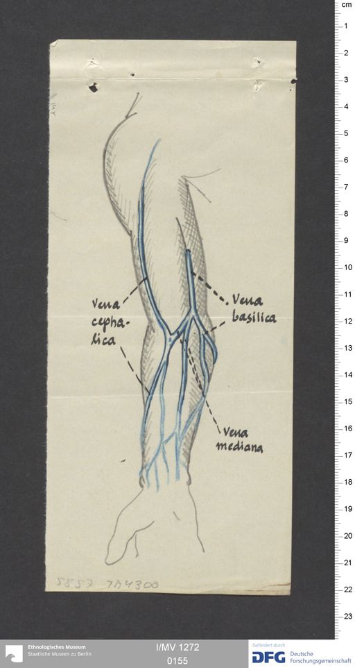 Acta XIII (Turfan) | (I/MV 1272 0155)